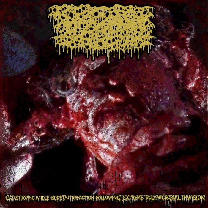 CATASTROPHIC WHOLE BODY PUTREFACTION FOLLOWING EXTREME POLYMICROBIAL INVASION