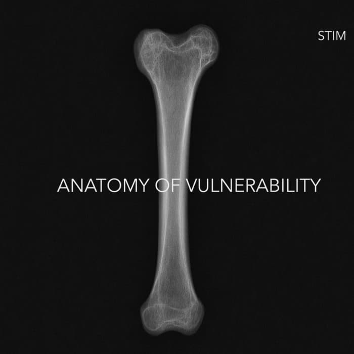 Anatomy of Vulnerability