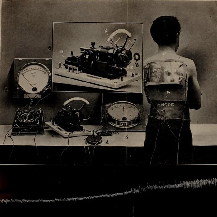 Electroanaesthesia (Single)