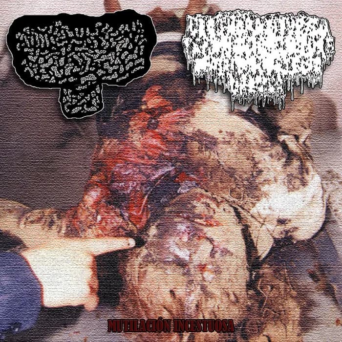 Mutilación incestuosa